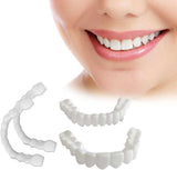 Snap in Teeth for Men and Women | الأسنان التركيب الفوري للرجال والنساء